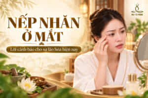 Nếp nhăn ở mắt: Lời cảnh báo cho sự lão hóa hiện nay