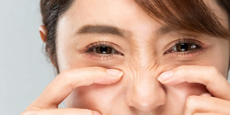 Nguyên nhân dẫn đến các nếp nhăn xuất hiện nhiều ở mắt